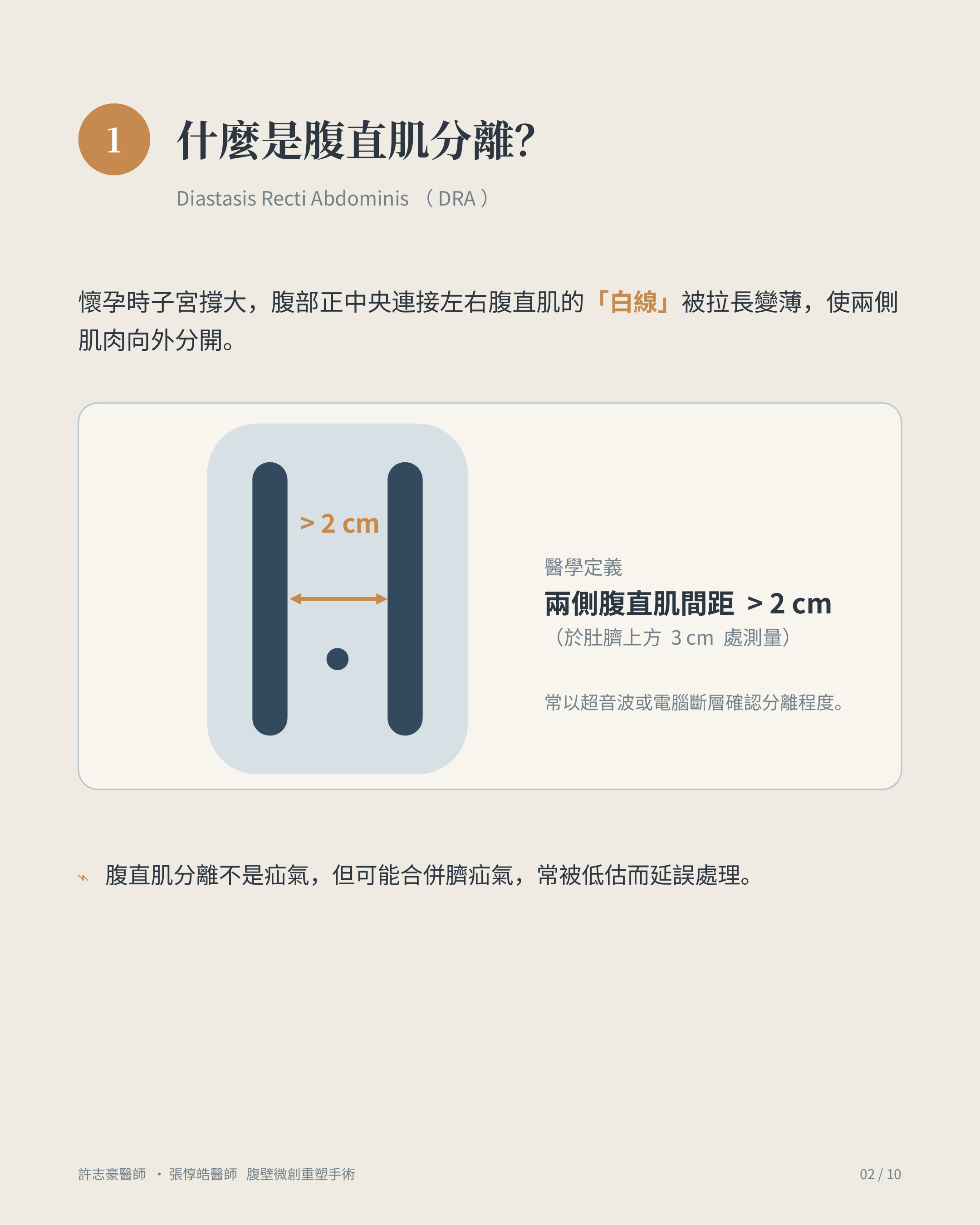 什麼是腹直肌分離:兩側腹直肌間距大於 2 公分