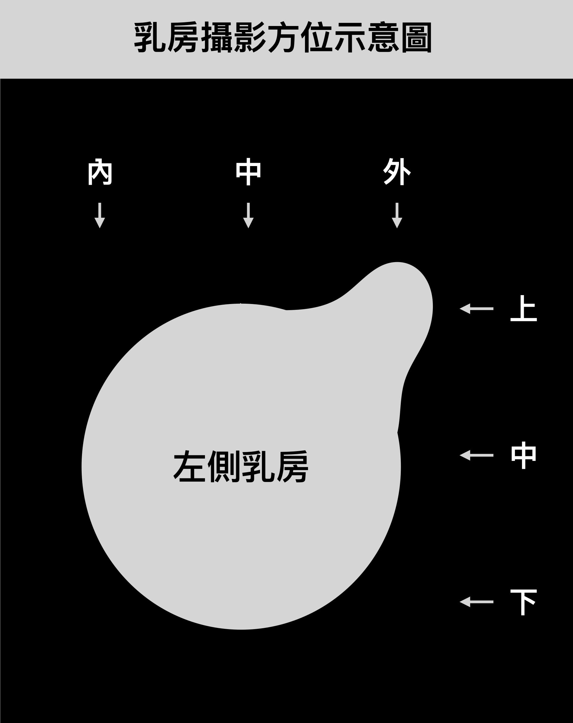 乳房攝影斜位向(MLO view)示意