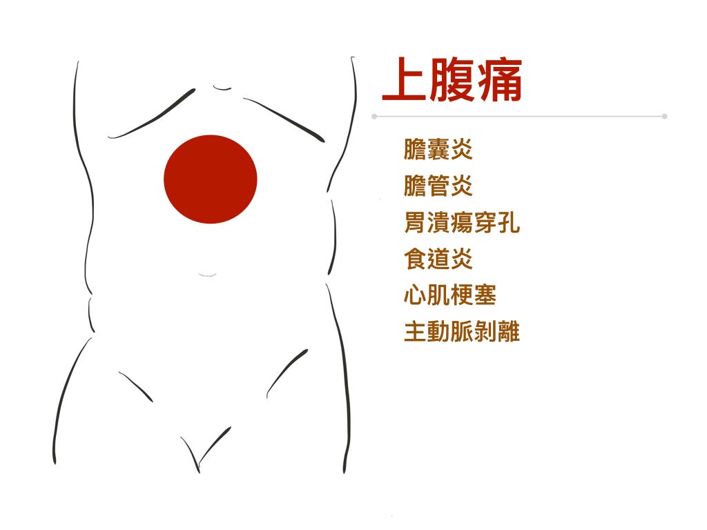 上腹痛