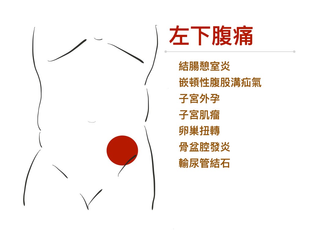 左下腹痛