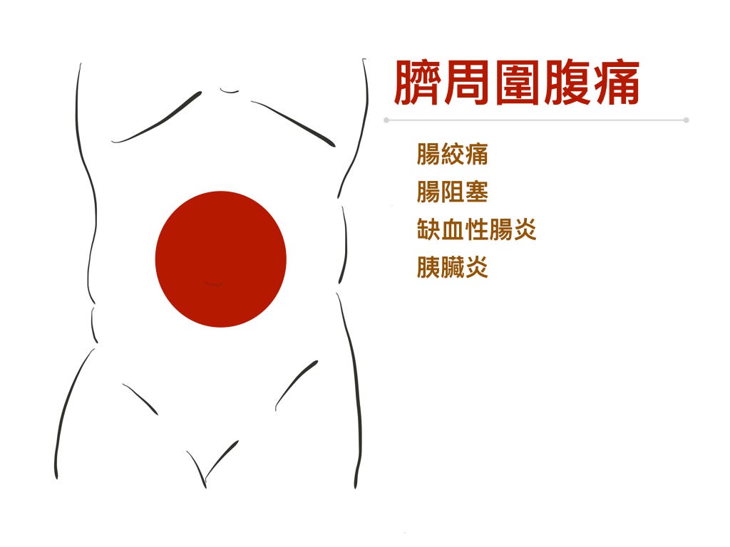 臍周圍腹痛