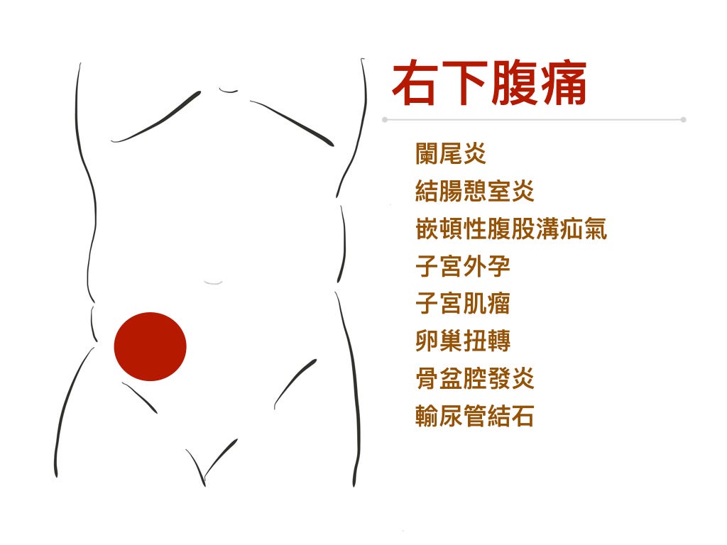 右下腹痛